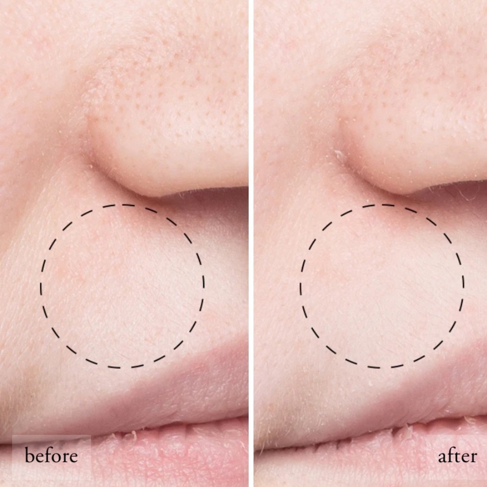 New! TWO philosophy purity made simple pore extractor clay masks 27609 - Picture 13 of 14